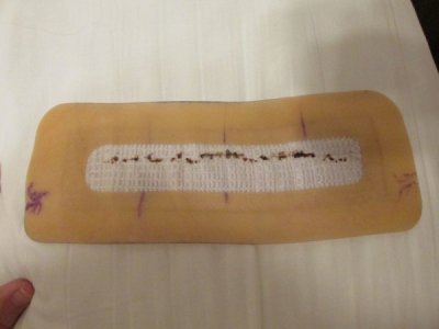 241001 003 bandage 002.jpg